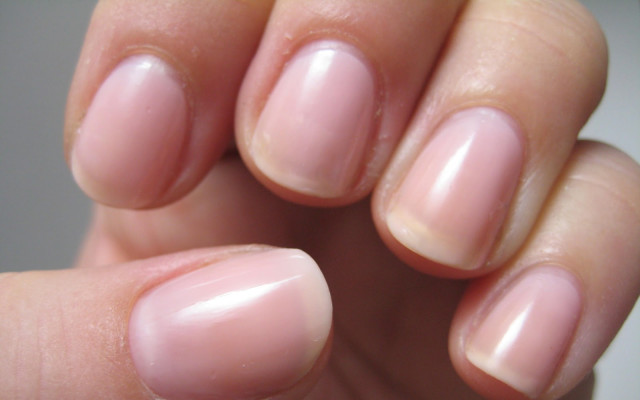 Understanding Nail Fungus Treatment