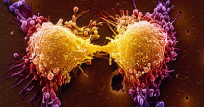Cancer drug development time halved thanks to artificial intelligence