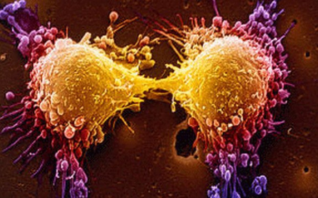 Cancer drug development time halved thanks to artificial intelligence