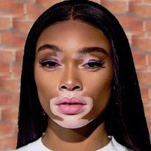 Winnie Harlow