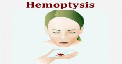 Hemoptysis  