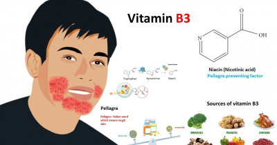 Vitamin B complex (Niacin)