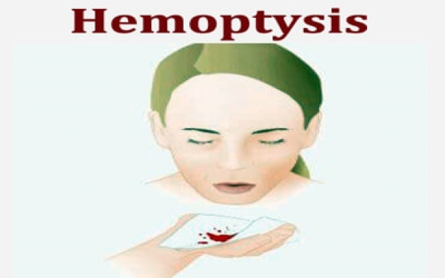 Hemoptysis  