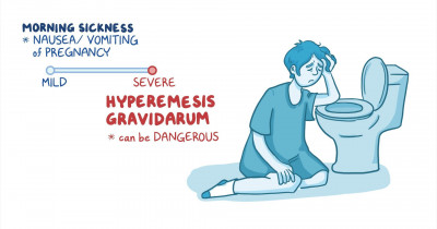 Hyperemesis gravidarum