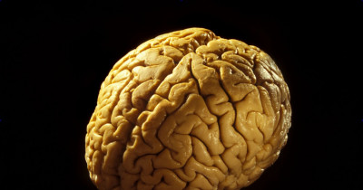 Cerebrum