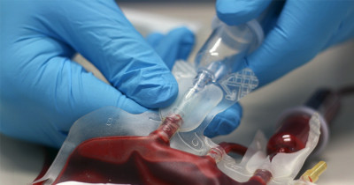 Blood transfusions reaction 