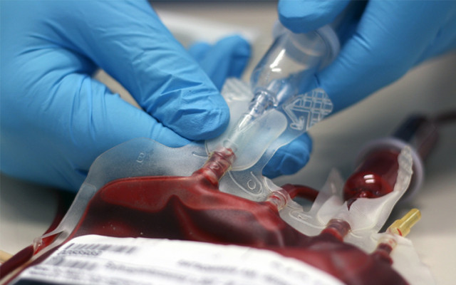 Blood transfusions reaction 