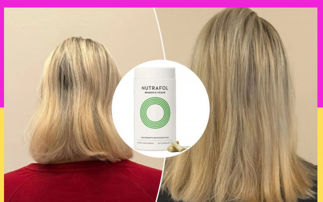 Unlocking Fuller, Healthier Hair: Why Nutrafol Deserves a 6-Month Try